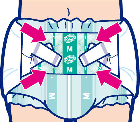 Stop gaps. Prevent leaks!